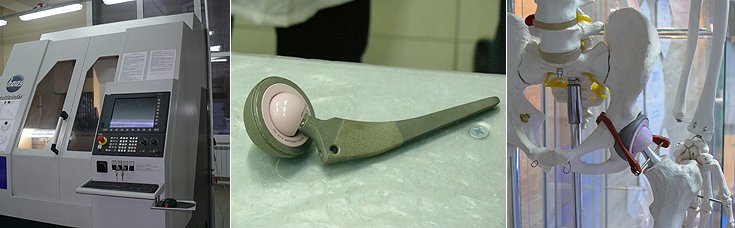 Компания «НЭВЗ-КЕРАМИКС» производит уникальные имплантаты тазобедренного сустава